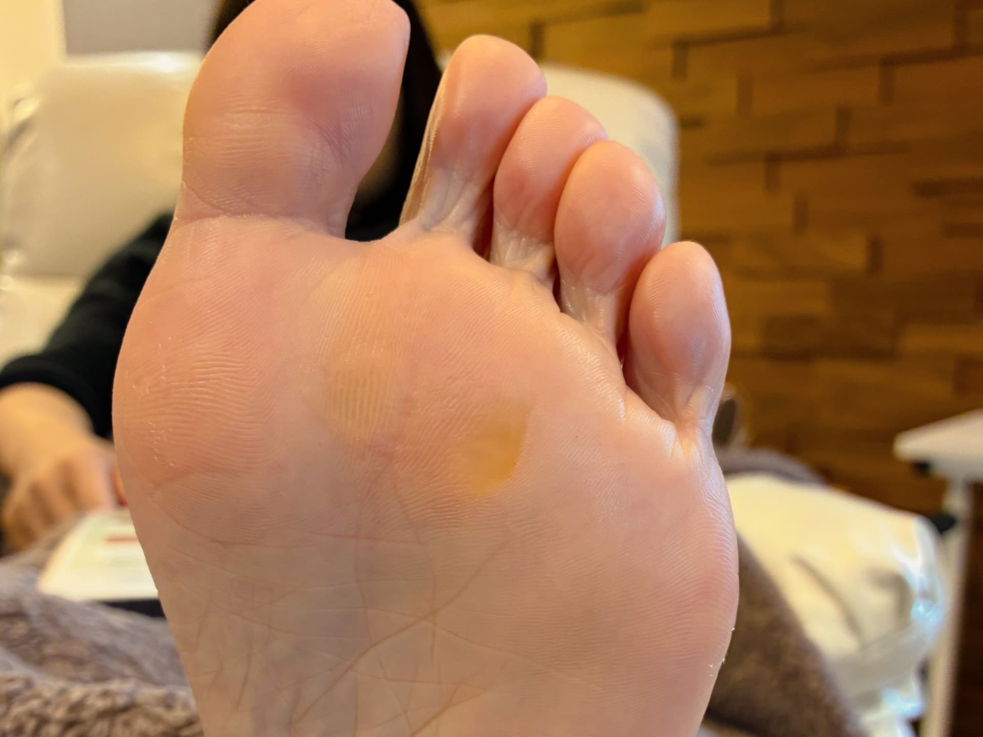 足裏角質ケア After