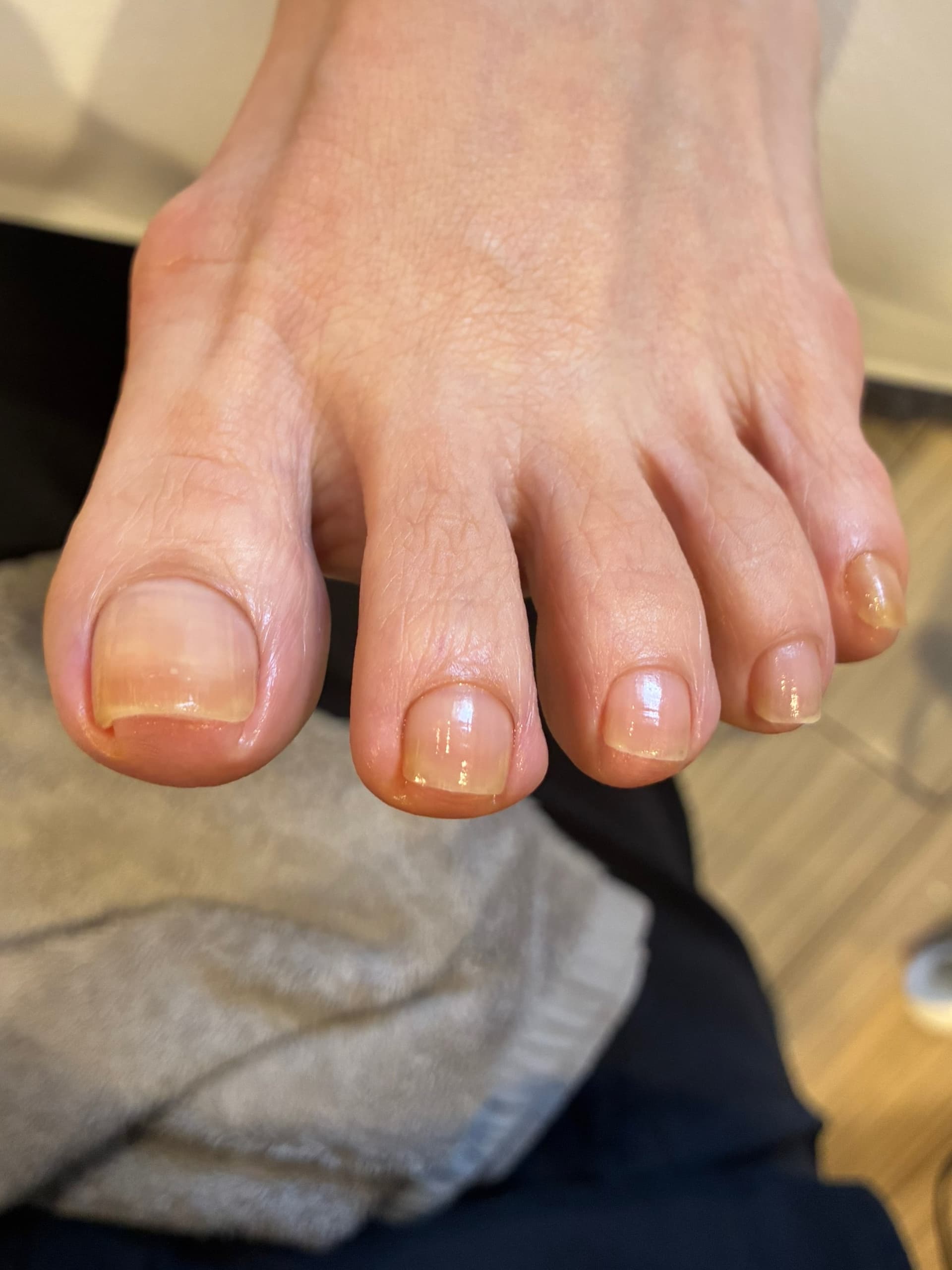 足爪ケア After